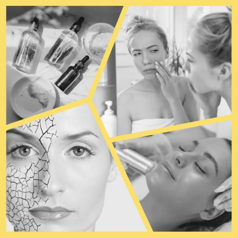 Summer Skin Recovery Guide